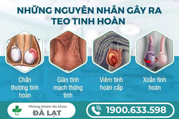 Hình ảnh minh họa